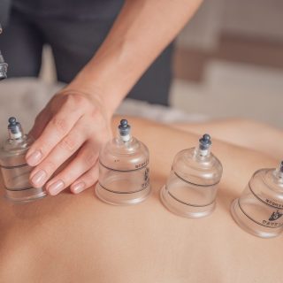 Cupping Therapy Treatment